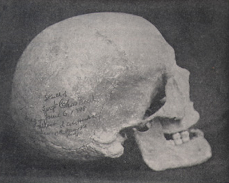 a human skull
