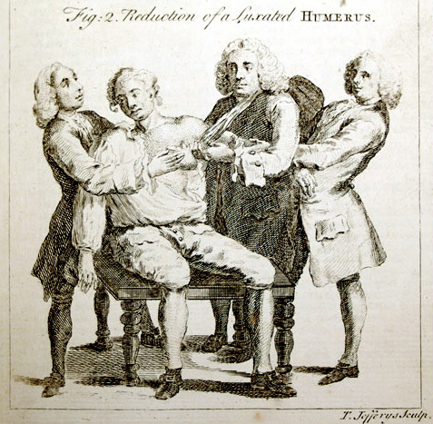 3 doctors attending to a dislocated shoulder