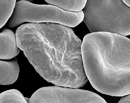 a cell with many little bumps surrounded by ones with smooth walls